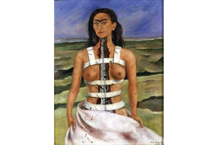 La colonna rotta di Frida Kahlo 
